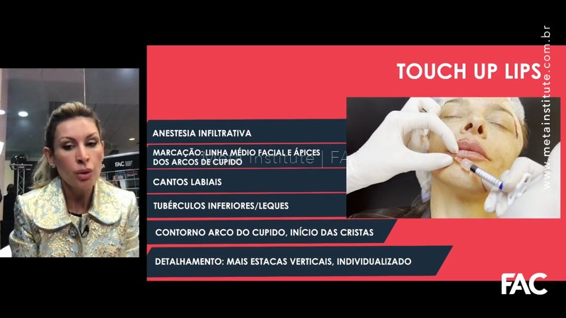 Aula 229 Bônus – Touch Lips AMWC