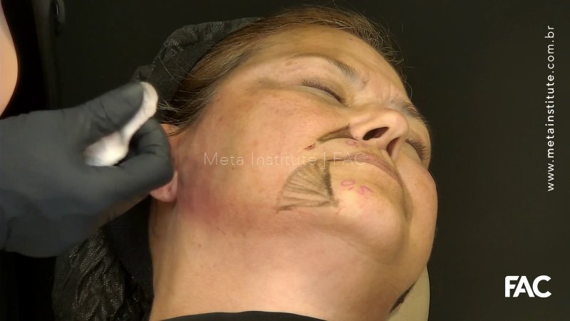 BIOSAFE bioestimulo FACIAL
